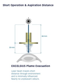 Lazer Göz uygulama tekniği, Excelsius Excimer Laser